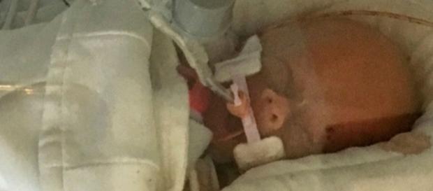 Morre bebê cuja mãe abandonou quimioterapia para manter gravidez Morre bebê cuja mãe abandonou quimioterapia para manter gravidez