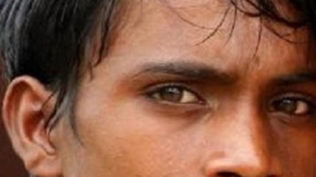 Discriminato e considerato dannato per la sua malformazione