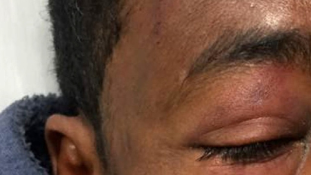 Tiburtino III: aggredito ospite del centro d'accoglienza - romatoday.it