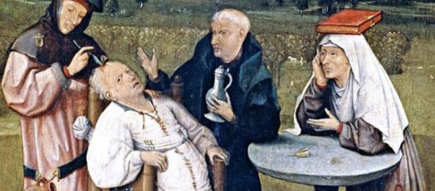 Desmitificando la trepanación en la Era Clásica y la Edad Media - anfrix.com Desmitificando la trepanación en la Era Clásica y la Edad Media - anfrix.com