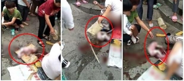 Jovem entra em trabalho de parto no meio da rua Jovem entra em trabalho de parto no meio da rua
