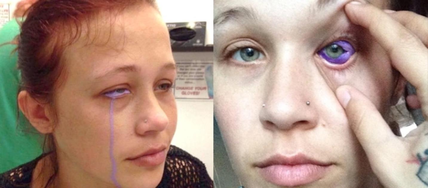 Modella si fa tatuare il bulbo oculare, piange lacrime