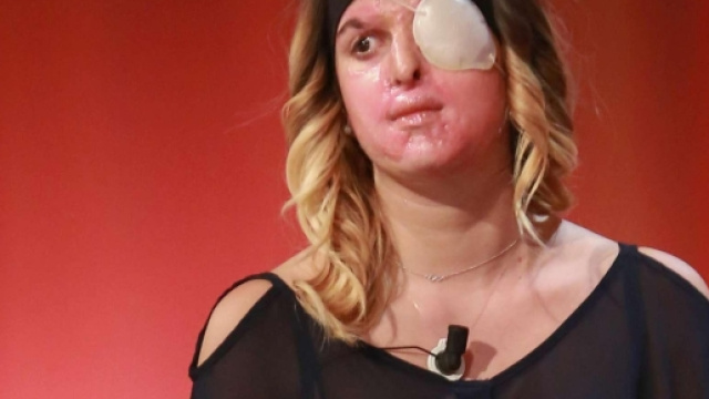 Gessica Notaro, nonostante sia in una situazione difficile fisica e psicologica, sta seguendo tutte le udienze