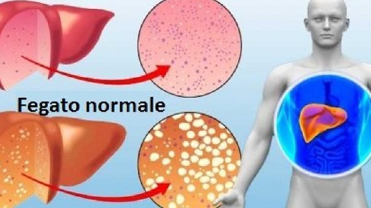 10 Consigli Per Disintossicare E Depurare Il Nostro Corpo