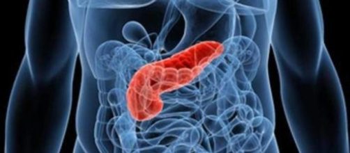 Tumore al pancreas: nuove scoperte per garantire diagnosi precoce - newsitaliane.it