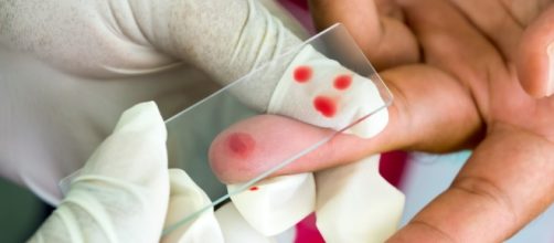 New single-dose malaria treatment could eventually help millions - theconversation.com