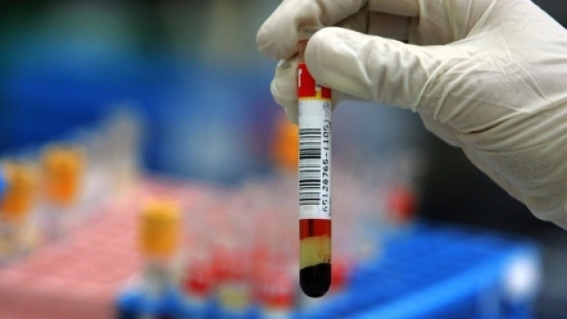 Alcol test: la Cassazione rivoluziona la validità delle analisi in ospedale