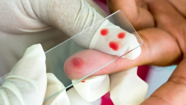 New single-dose malaria treatment could eventually help millions - theconversation.com