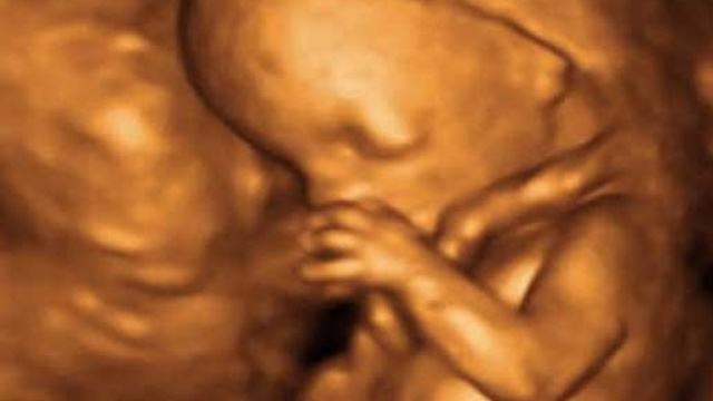 Feto in fase di sviluppo avanzato