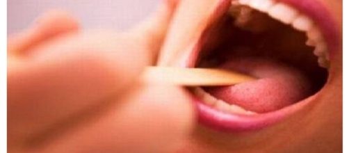 L’aumento dei tumori del cavo orale, nei giovani, potrebbe essere associato alle differenti abitudini sessuali delle nuove generazioni.