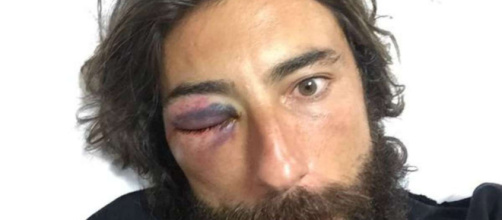 Vittorio Brumotti aggredito a Napoli, picchiato l'inviato di ... - lacittadisalerno.it