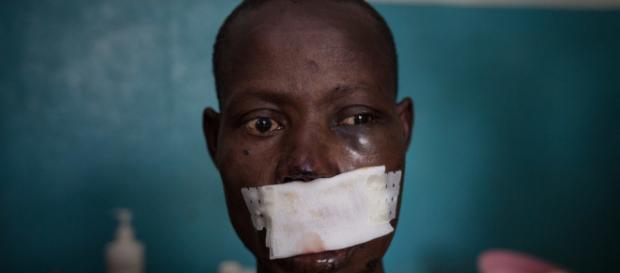 Léonard Gangbe, 33 anni, agricoltore, uomini armati gli hanno sparato alla testa. - Foto da Msf Léonard Gangbe, 33 anni, agricoltore, uomini armati gli hanno sparato alla testa. - Foto da Msf