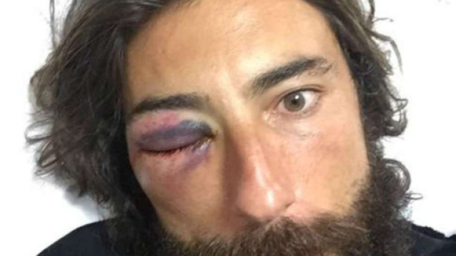 Vittorio Brumotti aggredito a Napoli, picchiato l'inviato di ... - lacittadisalerno.it