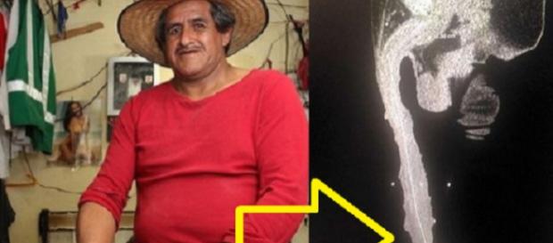 Homem com maior genitália sofre para conseguir emprego Homem com maior genitália sofre para conseguir emprego