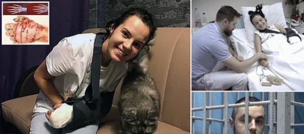 Galerie foto: Rusoaica la care soțul gelos i-a tăiat mâinile cu toporul face mărturisiri cutremurătoare - 6 - Sursa foto: Daily Mail Galerie foto: Rusoaica la care soțul gelos i-a tăiat mâinile cu toporul face mărturisiri cutremurătoare - 6 - Sursa foto: Daily Mail