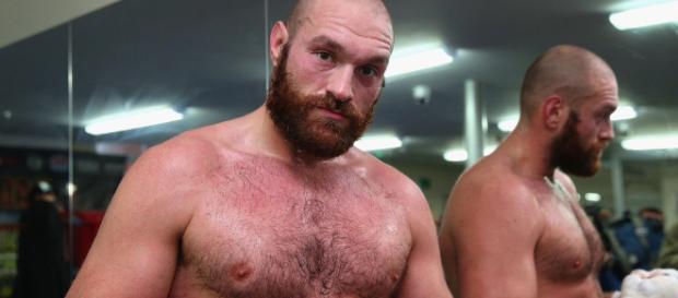 Tyson Furia regresa al ring para defender su cinturón Tyson Furia regresa al ring para defender su cinturón