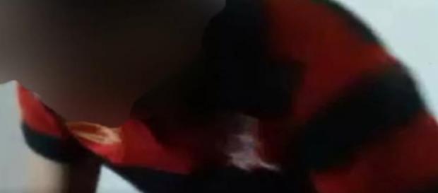 Horror que menina sofreu foi mostrado a partir de imagens que viralizaram Horror que menina sofreu foi mostrado a partir de imagens que viralizaram