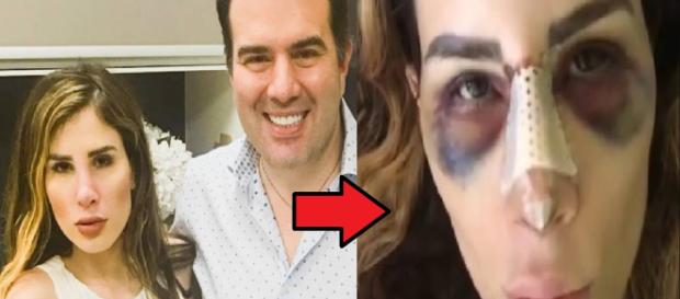Médico expõe farsa de Camilla Uckers e o que diz é de arrepiar Médico expõe farsa de Camilla Uckers e o que diz é de arrepiar
