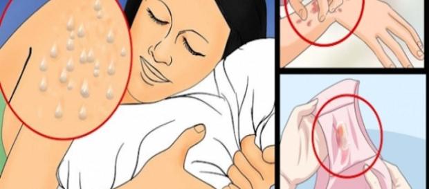 Conheça os sintomas típicos do HIV Conheça os sintomas típicos do HIV