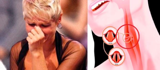 Voz estranha de Xuxa comove e mal é pior do que parece Voz estranha de Xuxa comove e mal é pior do que parece