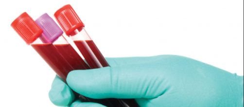 Test per il Cancro, con un prelievo del sangue si riconosceranno 8 tumori