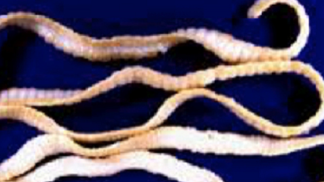 Un verme nell'intestino dopo aver mangiato sushi tutti i giorni
