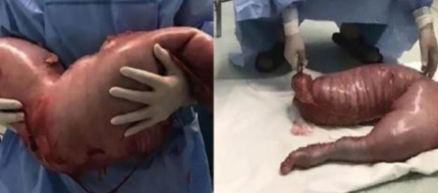 História de homem que tinha medo de ir ao médico acabou ficando famosa em todo o mundo. História de homem que tinha medo de ir ao médico acabou ficando famosa em todo o mundo.