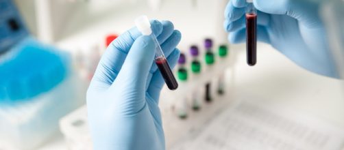CancerSEEK: test universale per scoprire 8 tipi di tumore - dhakatribune.com