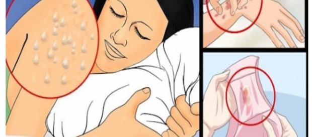 Imagem usada apena para fins ilustrativos Imagem usada apena para fins ilustrativos