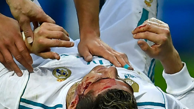 Real Madrid : CR7 aurait eu un accident ?