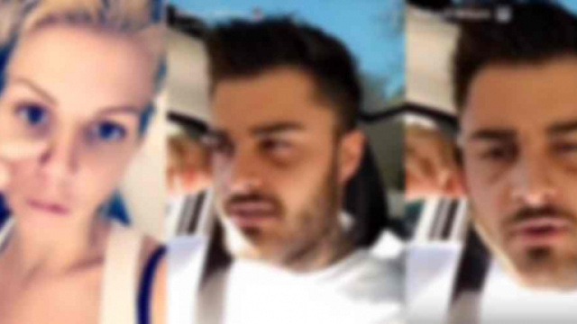 Jessica et Thibault dévoilent leurs nouveaux visages après la chirurgie esthétique !