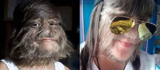 Mulher sofreu anos por aparência, mas achou quem a amava. (Foto Reprodução). Mulher sofreu anos por aparência, mas achou quem a amava. (Foto Reprodução).
