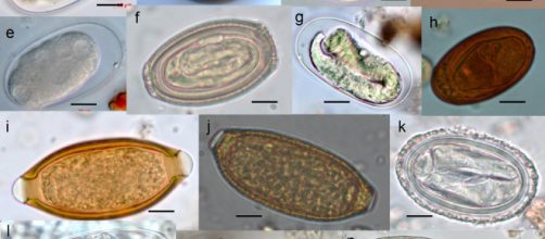 How to kill parasites naturally. [Image via By Roland Yao Wa Kouassi, Scott William McGraw/Wikiemedia]