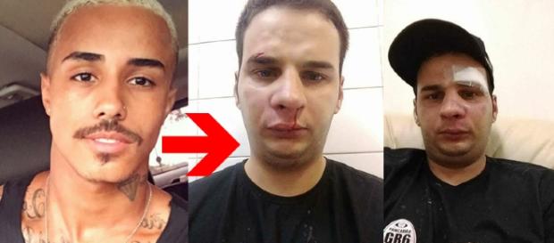 Técnico de som ficou bem machucado Técnico de som ficou bem machucado