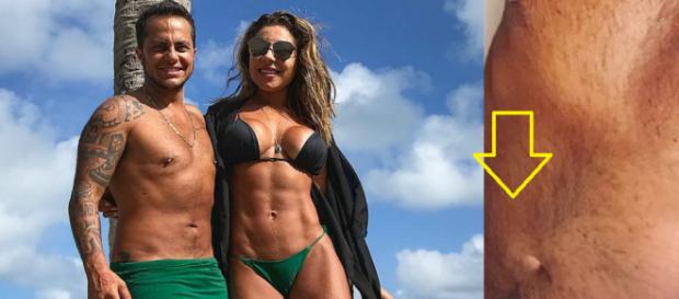 Thammy posa sem camisa e exibe cicatriz de cirurgia do seio Thammy posa sem camisa e exibe cicatriz de cirurgia do seio