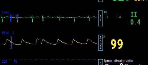 Infarto e ictus: scoperto un nuovo pericoloso fattore di rischio da conoscere