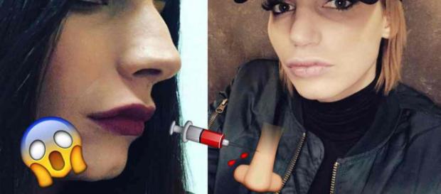Chirurgie esthétique : Nadège Lacroix (La Villa des Coeurs Brisés 3) déteste son nouveau nez ! Chirurgie esthétique : Nadège Lacroix (La Villa des Coeurs Brisés 3) déteste son nouveau nez !