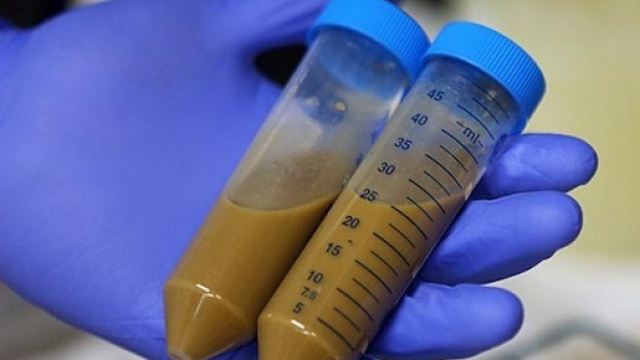 Una speranza contro le infezioni mortali: il trapianto di feci