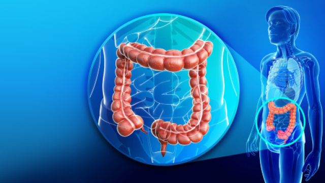 intestino infiammato. come riconoscere le cause
