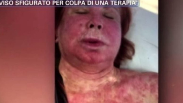 Marina Ripa di Meana video shock malattia