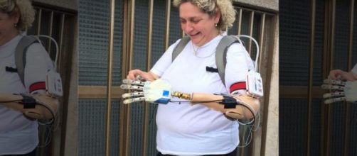 Prima mano bionica installata ad una donna veneta - foxnews.com