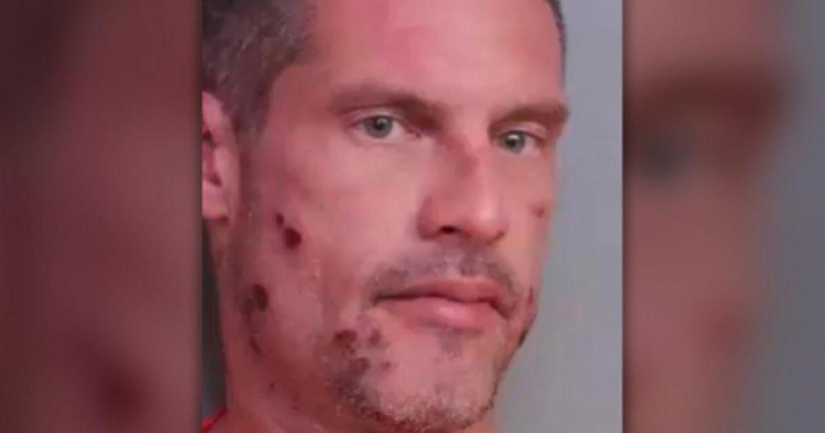 Listen as Florida man calls 911 to report his own DUI