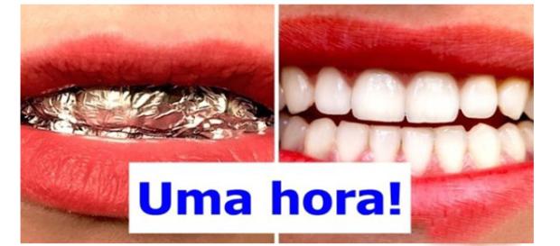 Dicas simples podem fazer a diferença ( Reprodução - BRIGHTSIDE ) Dicas simples podem fazer a diferença ( Reprodução - BRIGHTSIDE )