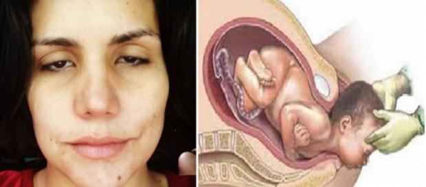 Ex-BBB famosa relata como foi dar à luz prematuramente Ex-BBB famosa relata como foi dar à luz prematuramente