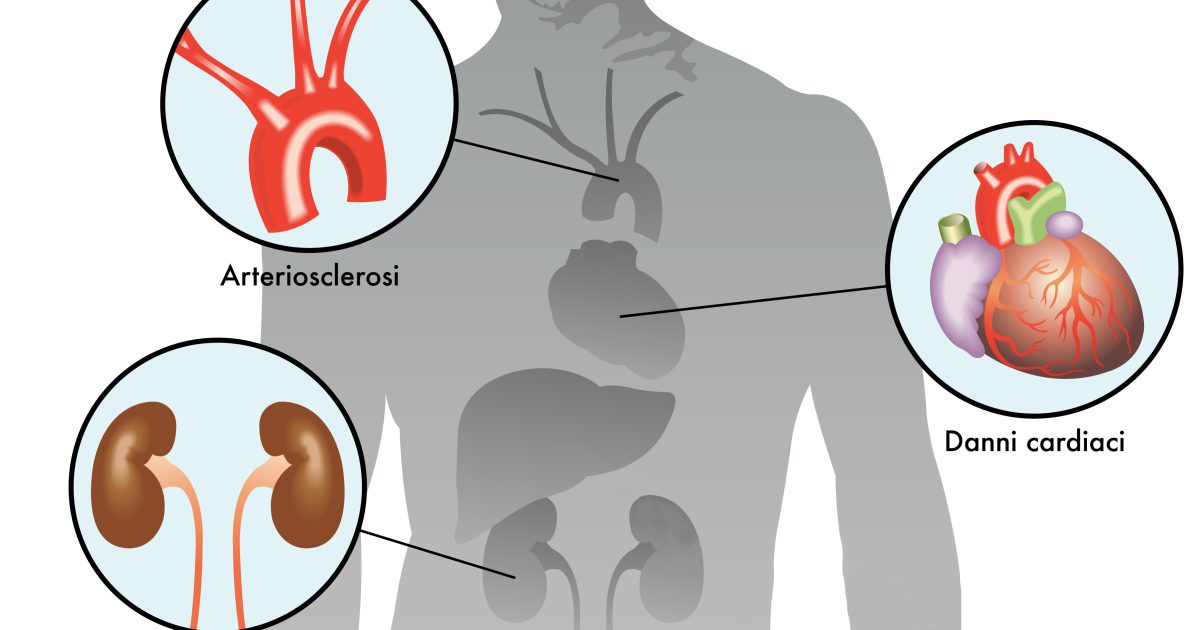 Diabete Di Tipo 2: Scoperto Il Farmaco Che Riduce Il Rischio Di Infarto ...