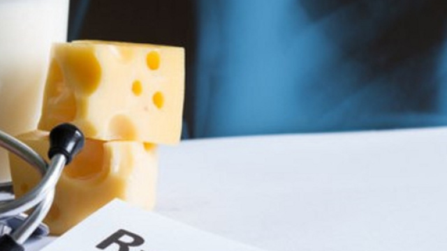 La dieta povera di calcio e la carenza di vitamina D possono causare fratture alle ossa. (Canva)