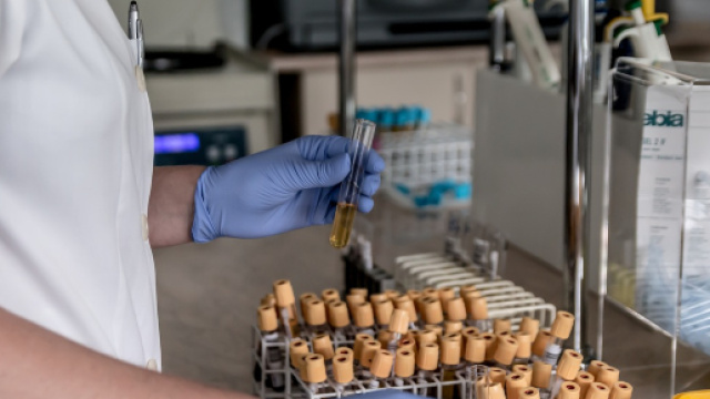 A Napoli ricoverati due pazienti, mamma e figlio, all'ospedale Cotugno per colera. Pi&ugrave; di 40 anni fa in citt&agrave; ci fu un'epidemia.