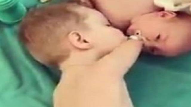 Francia, aumento di neonati senza arti