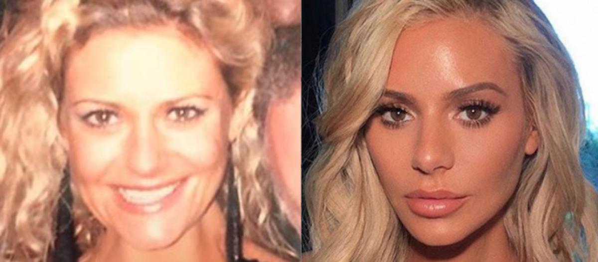 Did Rhobh S Dorit Kemsley Have Plastic Surgery Dr Jason Emer