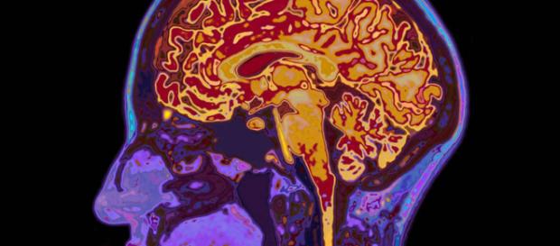 Il cervello 'continua' a funzionare anche dopo la morte, l'ipotesi di un esperto Il cervello 'continua' a funzionare anche dopo la morte, l'ipotesi di un esperto